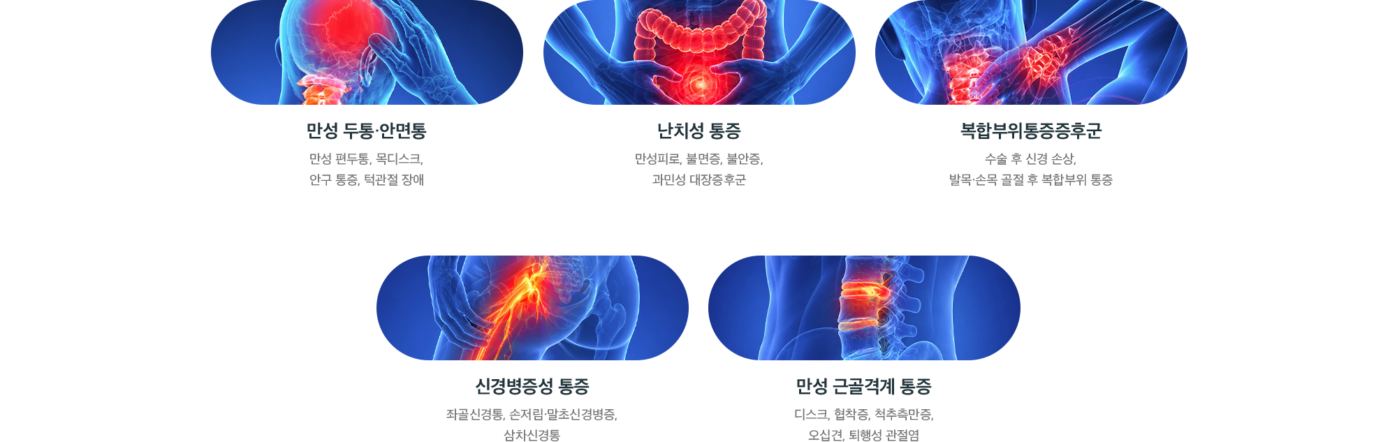 자율신경치료(SNEPI) 적용 질환 - 만성 두통·안면통, 난치성 통증, 복합부위통증증후군, 신경병증성 통증, 만성 근골격계 통증