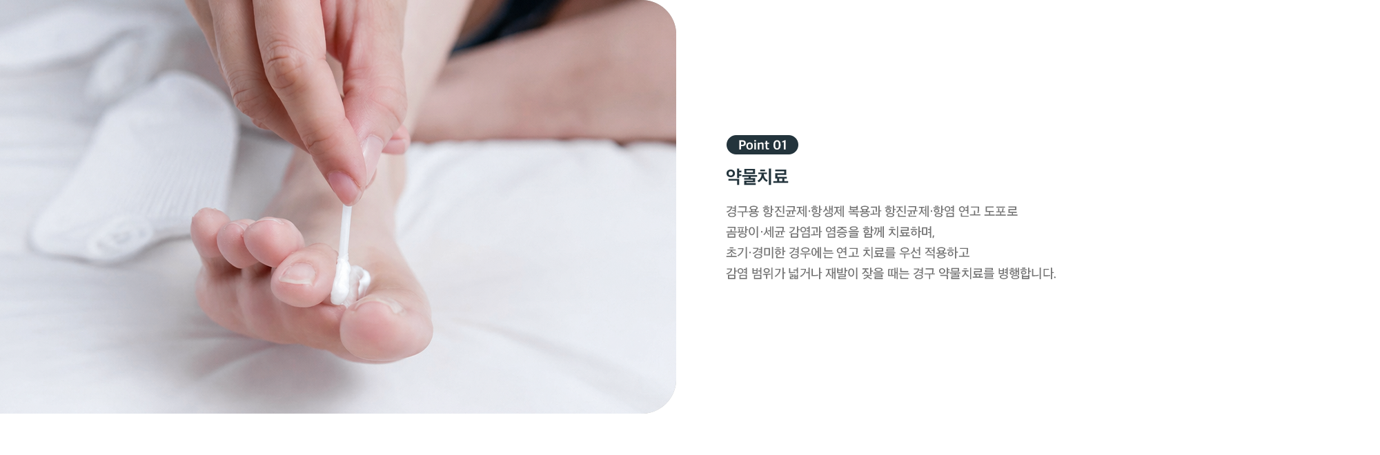 Point 01 - 문제성 발톱 약물치료, 항진균제·항생제와 연고 도포로 곰팡이·세균 감염과 염증 치료