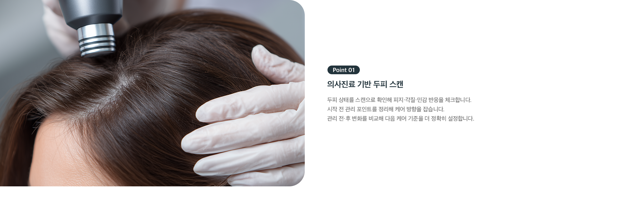 Point 01 - 의사진료 기반 두피 스캔, 피지·각질·민감 반응 체크 후 케어 방향 설정
