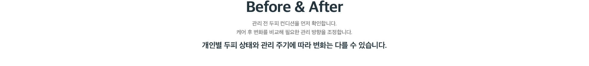 퍼펙트 헤드 스파 Before & After - 관리 전후 두피 컨디션 변화 비교