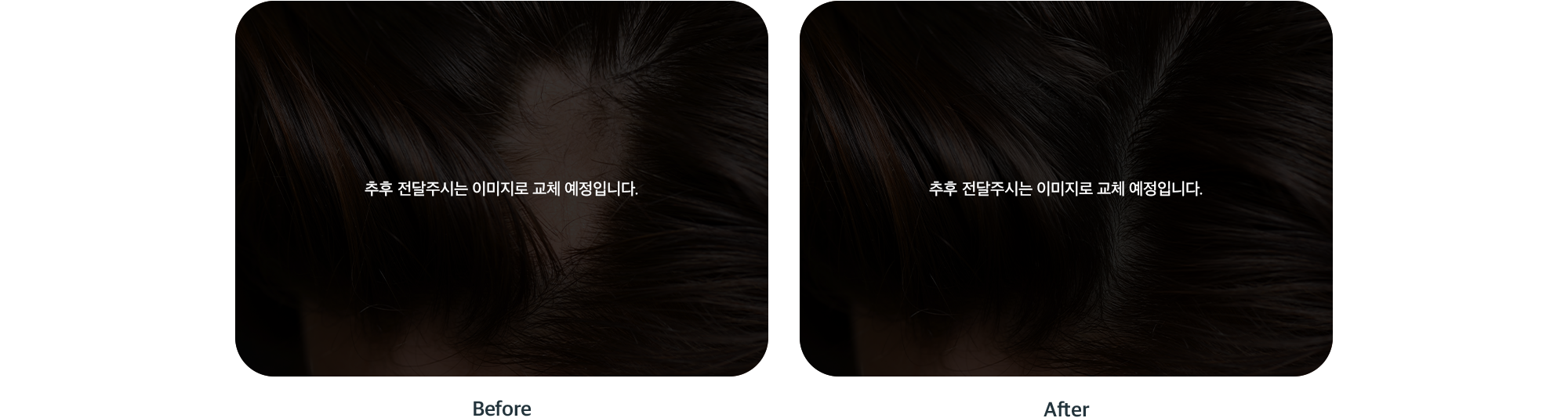 퍼펙트 헤드 스파 두피 관리 전후 비교 Before After