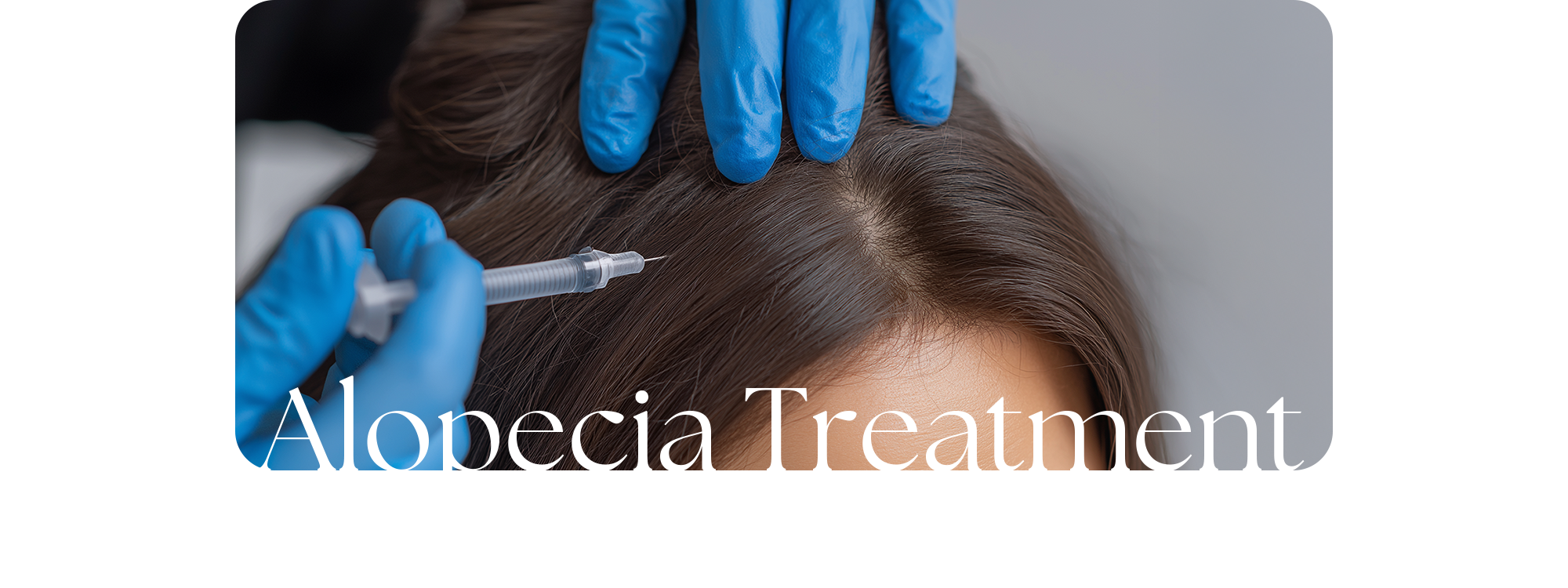 두피·모낭 상태에 맞춰 진행하는 퍼펙트 탈모 치료 Alopecia Treatment
