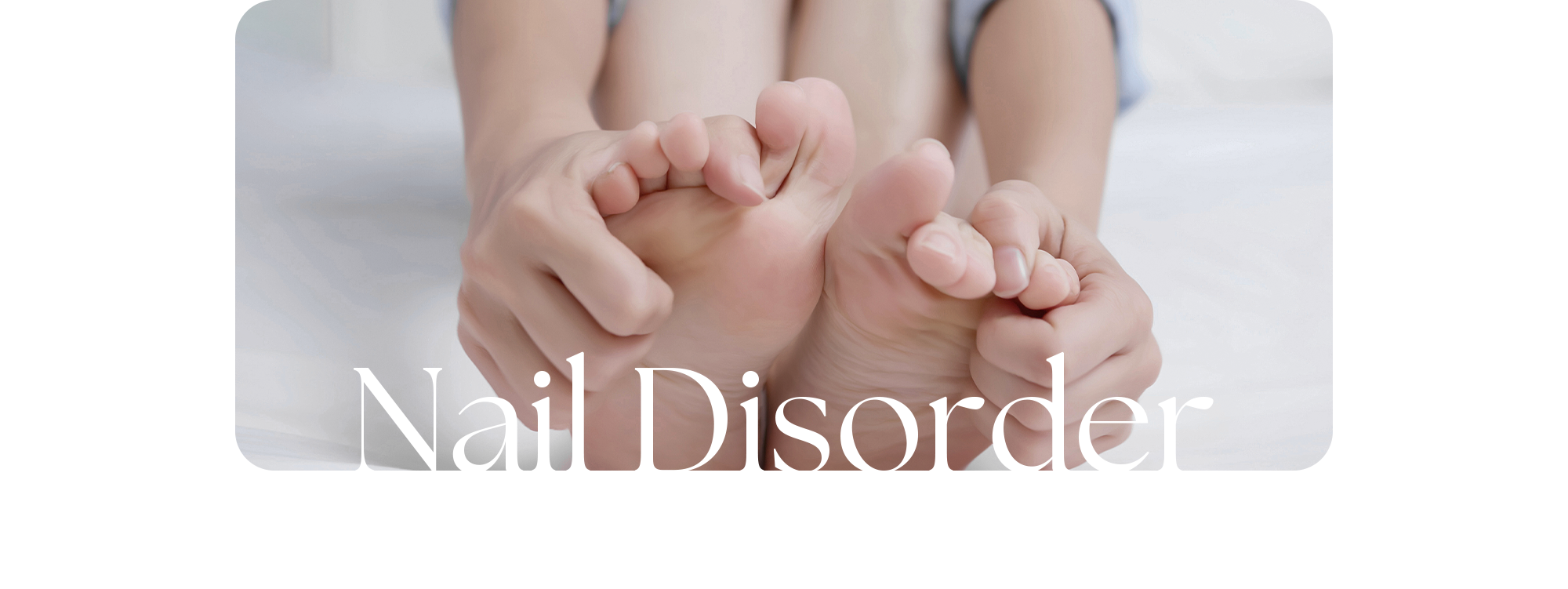 문제성 발톱(Nail Disorder)을 치료하는 시청역퍼펙트정형외과