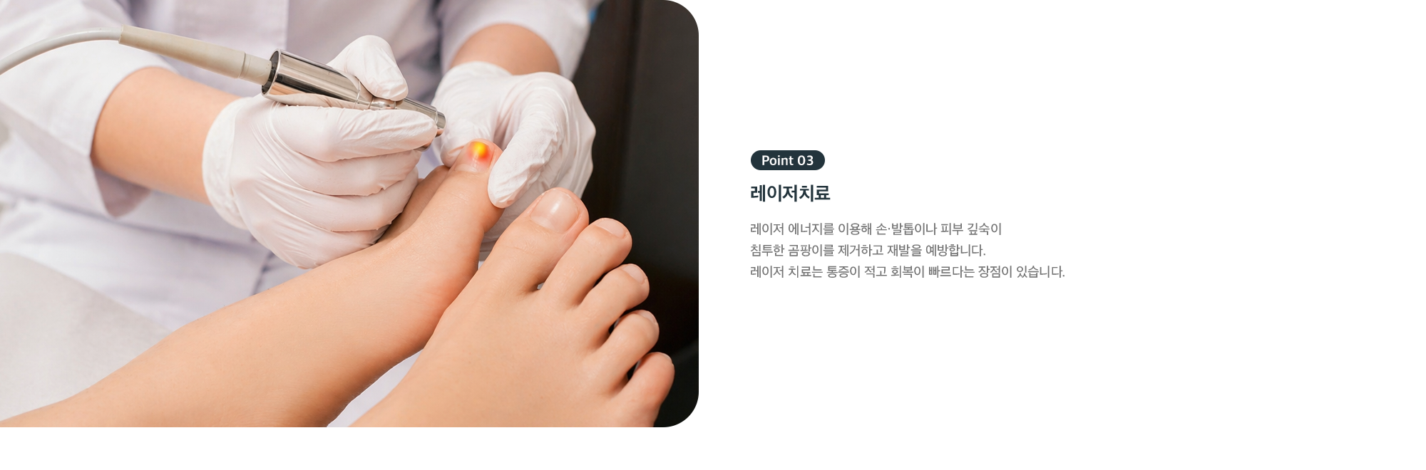Point 03 레이저치료 - 곰팡이 제거와 재발 예방, 통증 적고 빠른 회복